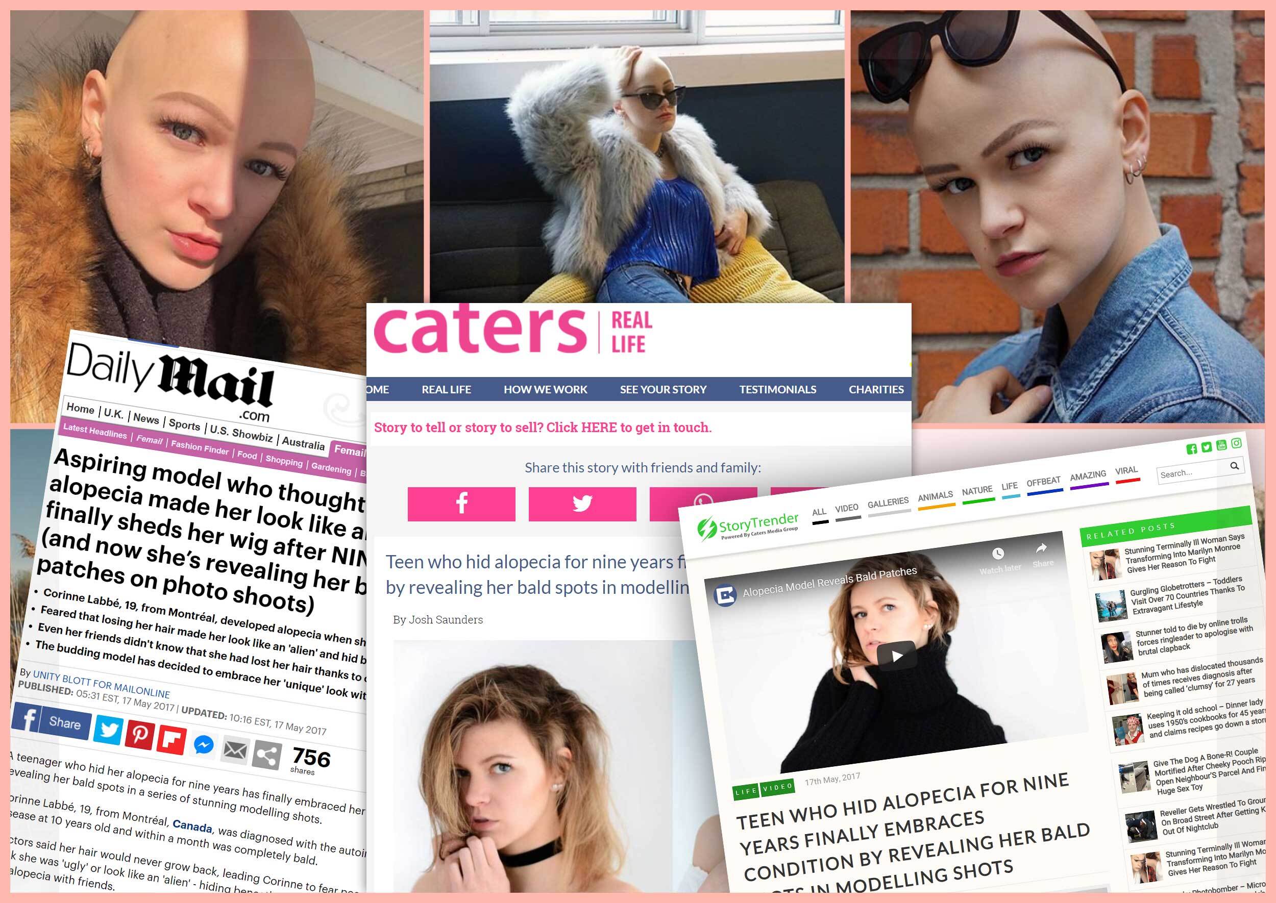 Nous sommes très fiers de notre modèle Corinne Labbée, qui ne s'est pas laissée décourager par le diagnostic d'alopécie.